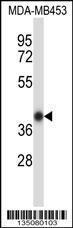 Anti-HOXC11 Rabbit Polyclonal Antibody (APC (Allophycocyanin))