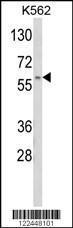 Anti-CDK5RAP1 Rabbit Polyclonal Antibody (AP (Alkaline Phosphatase))