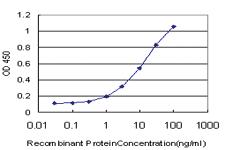 Anti-LIMK1 Mouse Monoclonal Antibody [clone: 1B2]