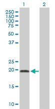 Anti-ADI1 Mouse Polyclonal Antibody