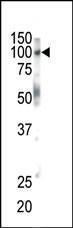 Anti-EPHB1 Rabbit Polyclonal Antibody (FITC (Fluorescein))