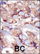 Anti-MYLK3 Rabbit Polyclonal Antibody (APC (Allophycocyanin))