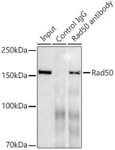 Immunoprecipitation analysis of 300µg extracts of K-562 cells using 3µg of Anti-Rad50 Antibody [ARC0854] (A308415). This Western blot was performed on the immunoprecipitate using Anti-Rad50 Antibody [ARC0854] (A308415) at a dilution of 1:1000.