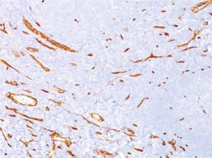 Immunohistochemical analysis of formalin-fixed, paraffin-embedded human kidney tissue using Anti-CD34 Antibody [CD34/4939]. Inset: PBS instead of the primary antibody. Secondary antibody negative control