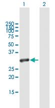 Anti-MRGBP Mouse Polyclonal Antibody