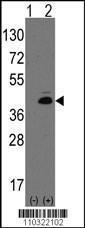 Anti-ATOH1 Rabbit Polyclonal Antibody (FITC (Fluorescein))