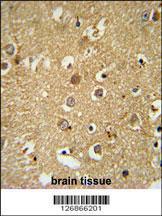 Anti-RAB11FIP2 Rabbit Polyclonal Antibody (FITC (Fluorescein Isothiocyanate))