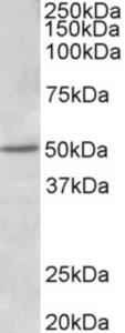 EB11581 (1 µg/ml) staining of Human Placenta lysate (35 µg protein in RIPA buffer). Primary incubation was 1 hour. Detected by chemiluminescence.