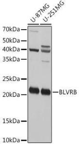 Western blot analysis of extracts of various cell lines, using Anti-FLR Antibody (A10093) at 1:1,000 dilution. The secondary antibody was Goat Anti-Rabbit IgG H&L Antibody (HRP) at 1:10,000 dilution.