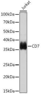 Western blot analysis of extracts of Jurkat cells, using Anti-CD7 Antibody [ARC1634] (A308416) at 1:1,000 dilution