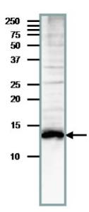 Anti-MED11 Antibody