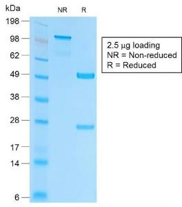 SDS-PAGE analysis of Anti-EpCAM Antibody [EGP40/2041R] under non-reduced and reduced conditions; showing intact IgG and intact heavy and light chains, respectively. SDS-PAGE analysis confirms the integrity and purity of the antibody.