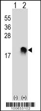 Anti-SUMO2/3 Rabbit Polyclonal Antibody