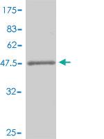 Anti-AMACR Mouse Polyclonal Antibody