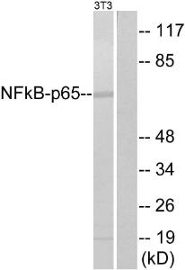 Anti-NF-kB p65 Rabbit Polyclonal Antibody