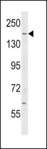 Anti-IQGAP2 Rabbit Polyclonal Antibody (FITC (Fluorescein Isothiocyanate))