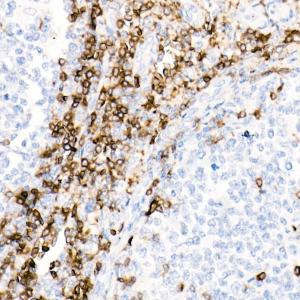 Immunohistochemistry analysis of paraffin-embedded human tonsil using Anti-CD7 Antibody [ARC1634] (A308416) at a dilution of 1:10000 (40X lens). Perform high pressure antigen retrieval with 10 mM Tris/EDTA buffer pH 9.0 before commencing with IHC staining protocol