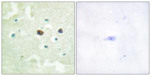 Immunohistochemical analysis of paraffin-embedded human brain using Anti-PTP1B (phospho Ser50) Antibody. The right hand panel represents a negative control, where the antibody was pre-incubated with the immunising peptide.