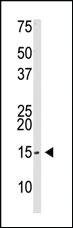 Anti-SUMO2/3 Rabbit Polyclonal Antibody