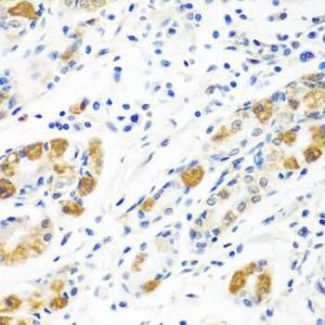 Immunohistochemistry analysis of paraffin-embedded human stomach using Anti-FLR Antibody (A10093) at a dilution of 1:100 (40x lens)