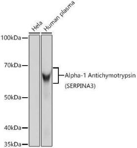 Western blot analysis of extracts of various cell lines, using Anti-AACT Antibody [ARC0581] (A80802) at 1:1,000 dilution. The secondary antibody was Goat Anti-Rabbit IgG H&L Antibody (HRP) at 1:10,000 dilution.