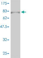 Anti-RARA Mouse Monoclonal Antibody [clone: 2C9-1F8]