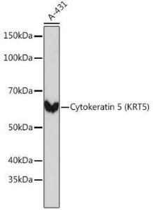 Western blot analysis of extracts of A-431 cells, using Anti-Cytokeratin 5 Antibody [ARC0585] (A80808) at 1:1,000 dilution The secondary antibody was Goat Anti-Rabbit IgG H&L Antibody (HRP) at 1:10,000 dilution Lysates/proteins were present at 25 µg per lane