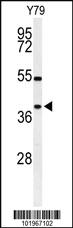 Anti-SIRT3 Rabbit Polyclonal Antibody