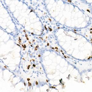 Immunohistochemistry analysis of paraffin-embedded human colon tissue using Anti-CD7 Antibody [ARC1634] (A308416) at a dilution of 1:10000 (40X lens). Perform high pressure antigen retrieval with 10 mM Tris/EDTA buffer pH 9.0 before commencing with IHC staining protocol