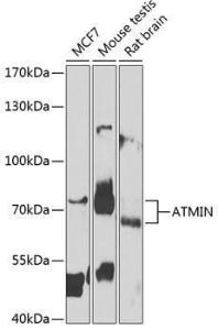 Western blot analysis of extracts of various cell lines, using Anti-ATMIN Antibody (A10095) at 1:1,000 dilution. The secondary antibody was Goat Anti-Rabbit IgG H&L Antibody (HRP) at 1:10,000 dilution.