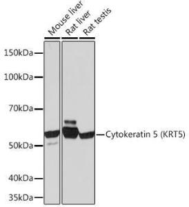 Western blot analysis of extracts of various cell lines, using Anti-Cytokeratin 5 Antibody [ARC0585] (A80808) at 1:1,000 dilution The secondary antibody was Goat Anti-Rabbit IgG H&L Antibody (HRP) at 1:10,000 dilution Lysates/proteins were present at 25 µg per lane