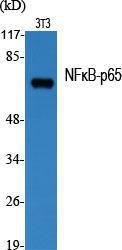 Anti-NF-kB p65 Rabbit Polyclonal Antibody