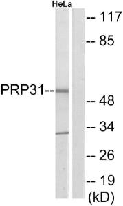 Western blot analysis of lysates from HeLa cells using Anti-PRP31 Antibody The right hand lane represents a negative control, where the antibody is blocked by the immunising peptide