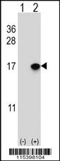 Anti-SUMO2/3 Rabbit Polyclonal Antibody