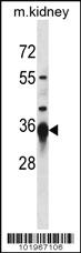 Anti-SIRT3 Rabbit Polyclonal Antibody