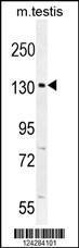 Anti-CIC Rabbit Polyclonal Antibody (AP (Alkaline Phosphatase))