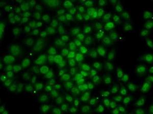 Immunofluorescence analysis of MCF-7 cells using Anti-ATMIN Antibody (A10095)