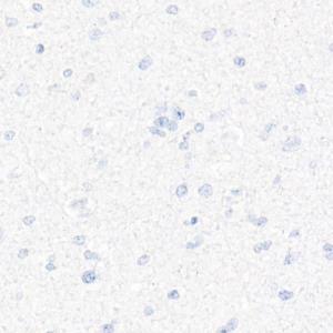 Immunohistochemistry analysis of paraffin-embedded human brain (negative control sample) using Anti-CD7 Antibody [ARC1634] (A308416) at a dilution of 1:10000 (40X lens). Perform high pressure antigen retrieval with 10 mM Tris/EDTA buffer pH 9.0 before commencing with IHC staining protocol