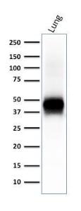 Western blot analysis of human lung lysate using Anti-EpCAM Antibody [EGP40/2041R]