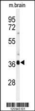 Anti-SEMA4C Rabbit Polyclonal Antibody