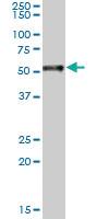 Anti-RARA Mouse Monoclonal Antibody [clone: 2C3]