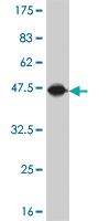 Anti-NAA20 Mouse Monoclonal Antibody [clone: 2C6]