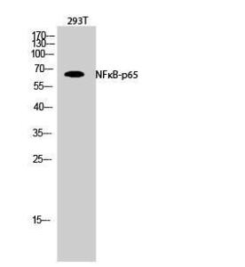 Anti-NF-kB p65 Rabbit Polyclonal Antibody