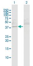 Anti-MAPKAPK3 Rabbit Polyclonal Antibody