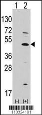 Anti-ATOH1 Rabbit Polyclonal Antibody (Biotin)