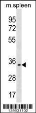 Anti-TREML1 Rabbit Polyclonal Antibody (HRP (Horseradish Peroxidase))