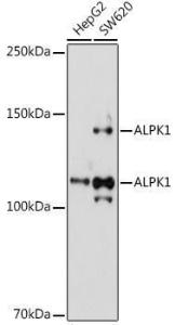 Western blot analysis of extracts of various cell lines, using Anti-ALPK1 Antibody (A308417) at 1:1,000 dilution The secondary antibody was Goat Anti-Rabbit IgG H&L Antibody (HRP) at 1:10,000 dilution Lysates/proteins were present at 25 µg per lane