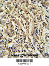 Anti-SEMA4C Rabbit Polyclonal Antibody