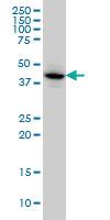 Anti-MAPKAPK3 Mouse Monoclonal Antibody [clone: 3F4]