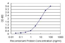 Anti-PNMA1 Antibody Pair